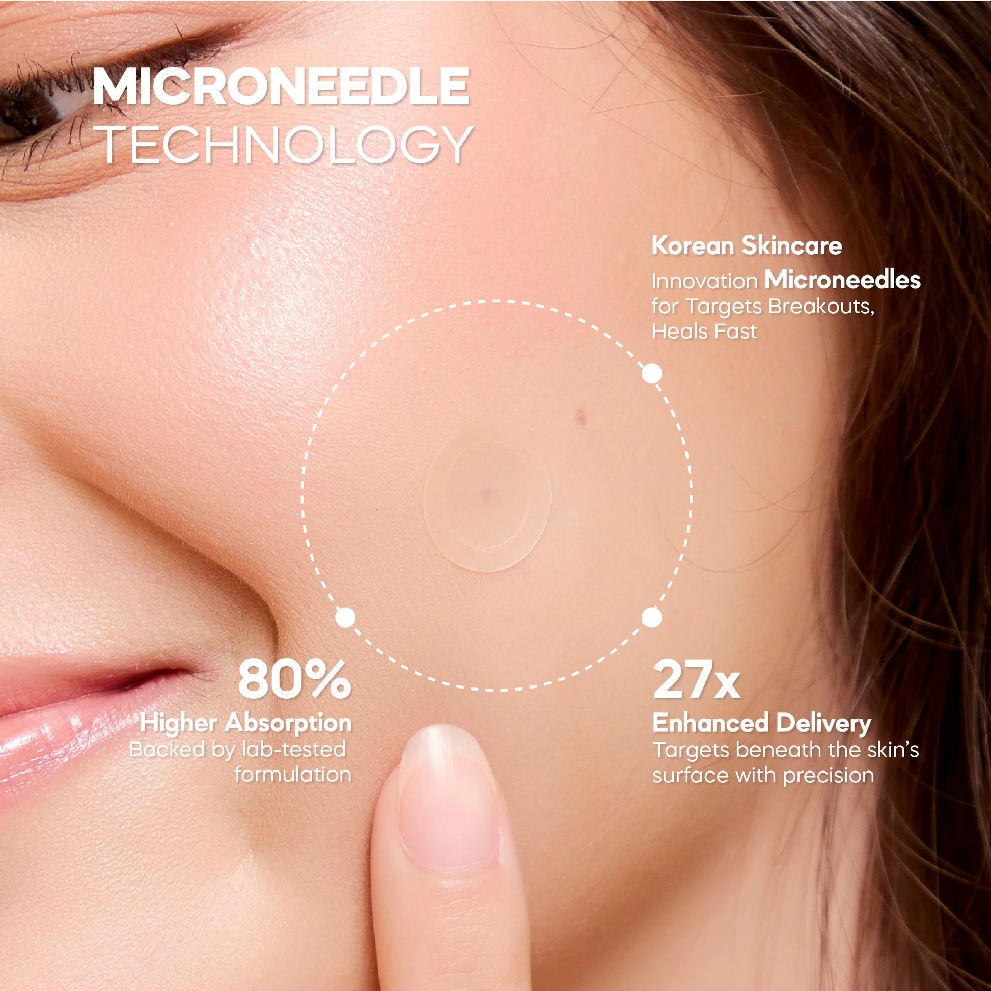 The Awesome Dot — microneedle technology